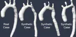 Synthetic Database of Aortic Morphometry and Hemodynamics: Overcoming Medical Imaging Data Availability